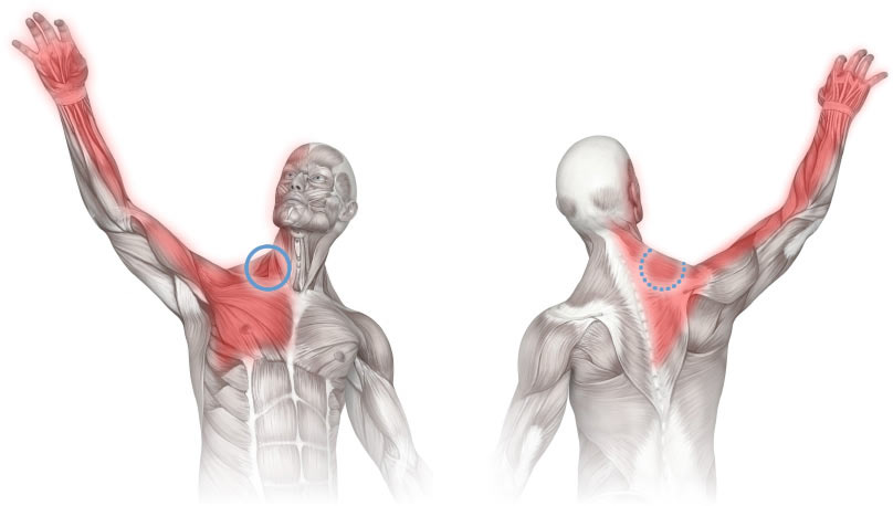 upper arm muscles pain