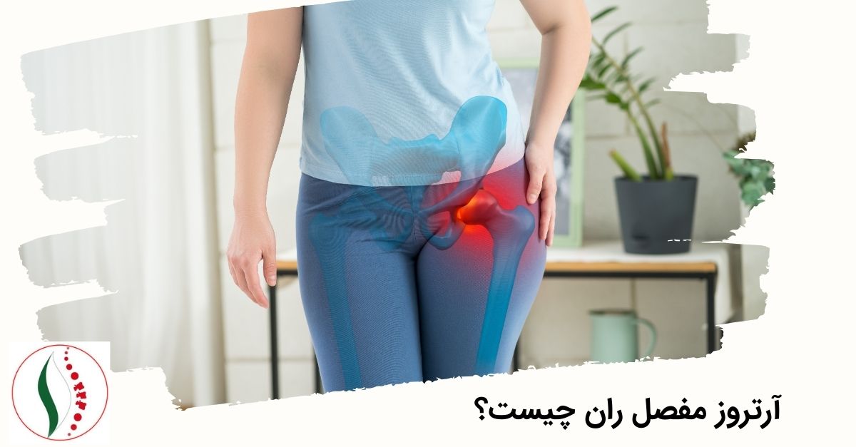 آرتروز مفصل ران چیست؟
