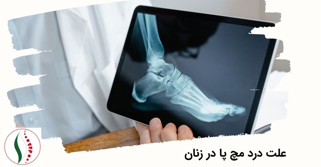 علت درد مچ پا در زنان