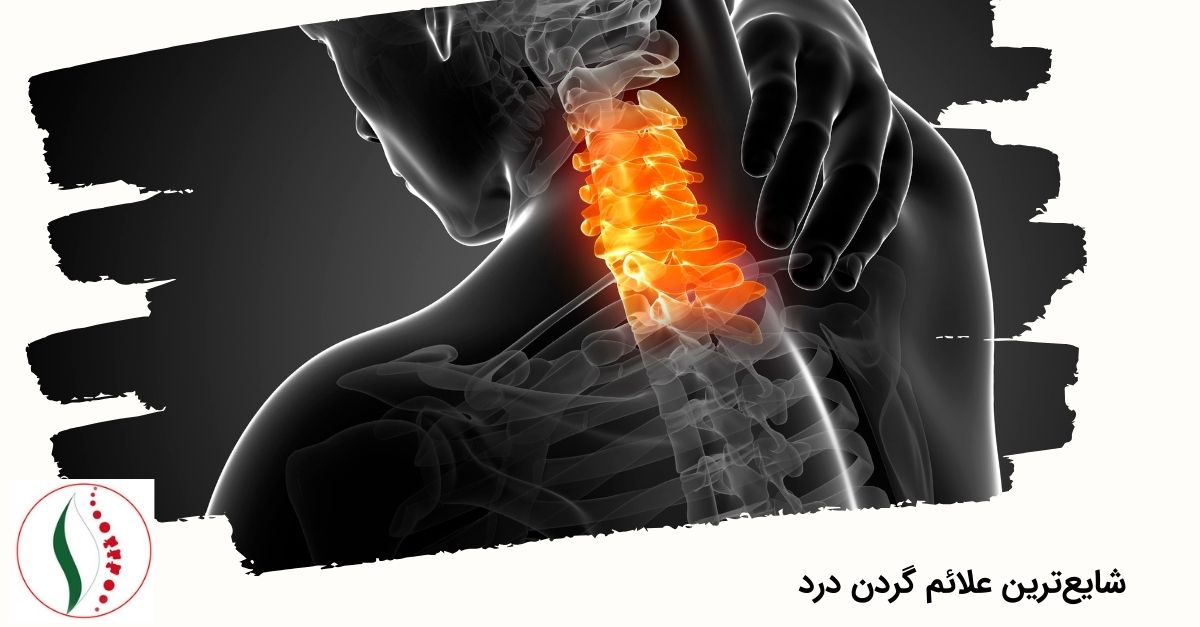 شایع‌ترین علائم گردن درد