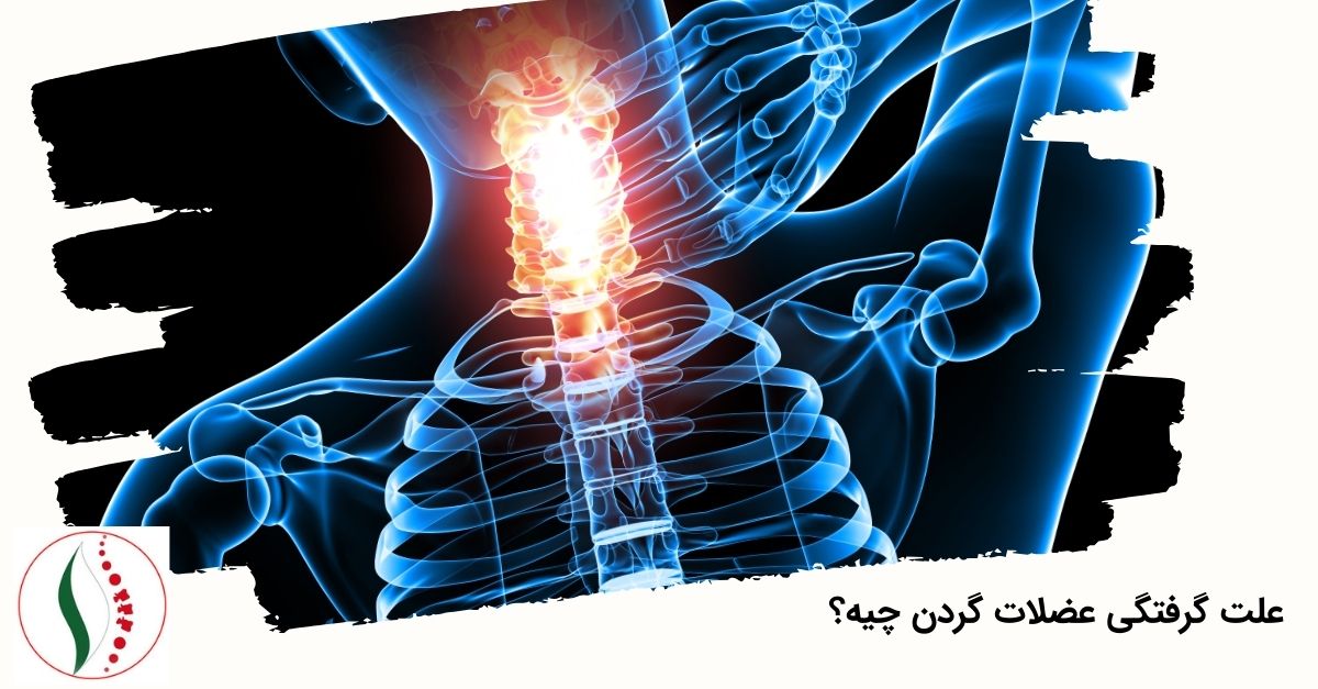 علت گرفتگی عضلات گردن چیه؟