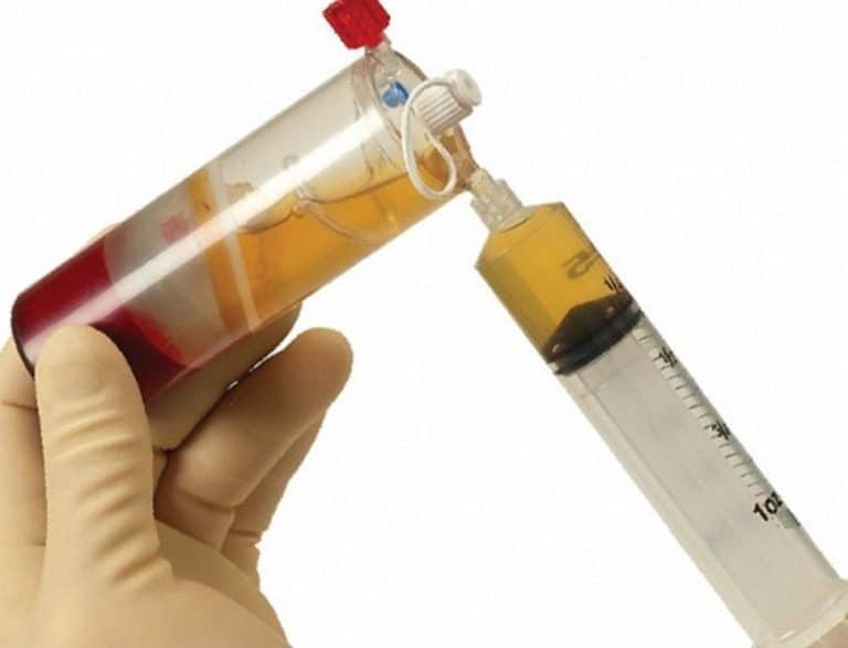 درمان با ارتوکین Orthokine