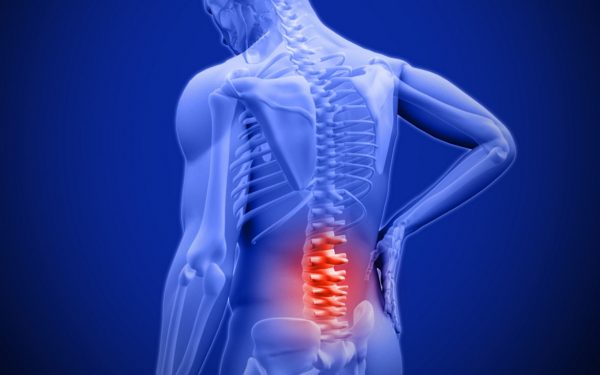 Low back pain treatment