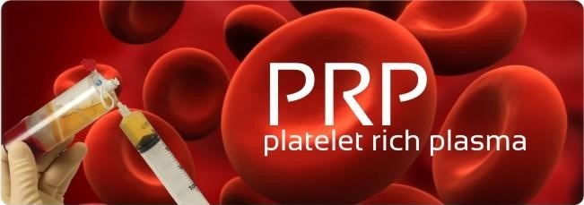 Platelet-rich plasma (PRP)
