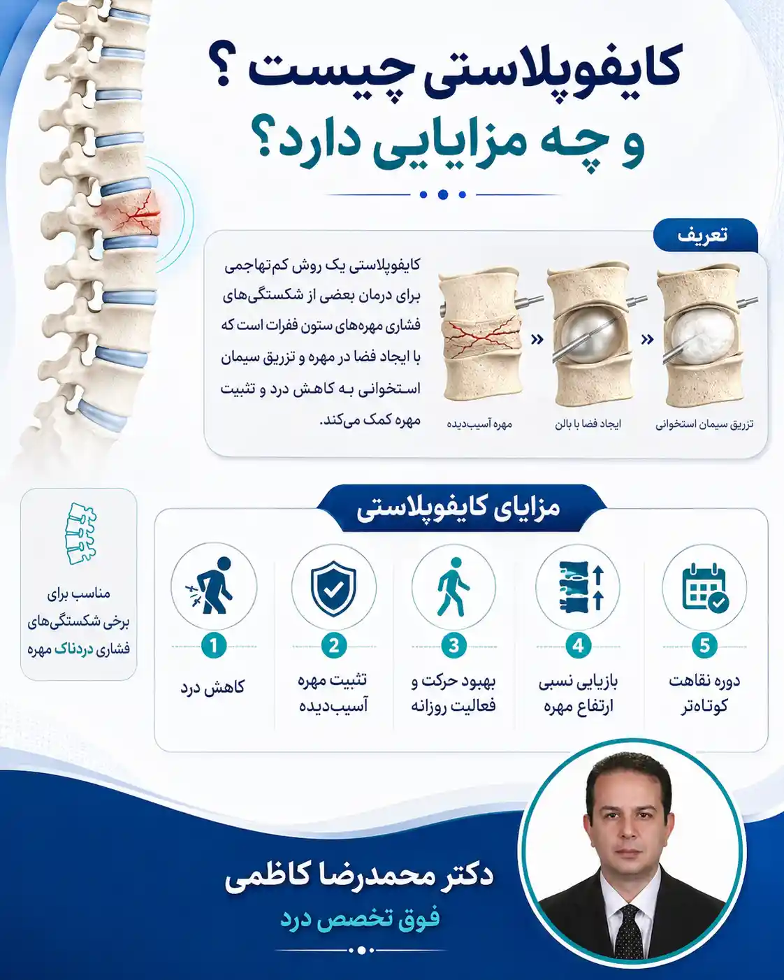 کایفوپلاستی چیست؟ و چه مزایایی دارد؟