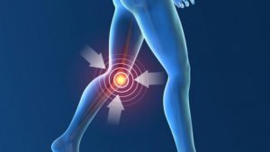 ما هو التهاب مفاصل الركبة وما هو العلاج