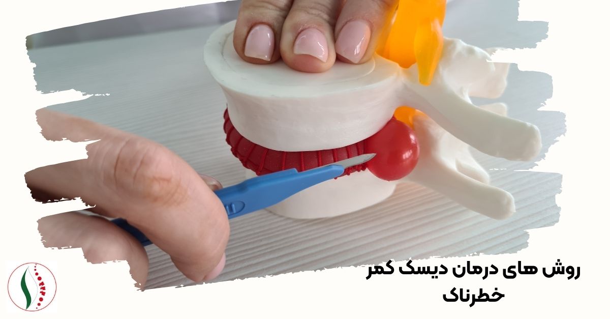 روش های درمان دیسک کمر خطرناک