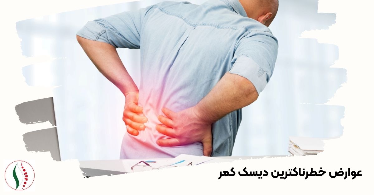 عوارض خطرناکترین دیسک کمر