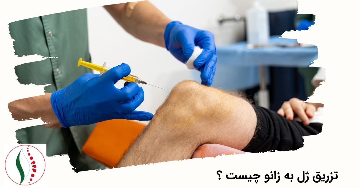 تزریق ژل به زانو چیست ؟