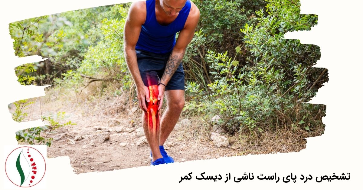 تشخیص درد پای راست ناشی از دیسک کمر 