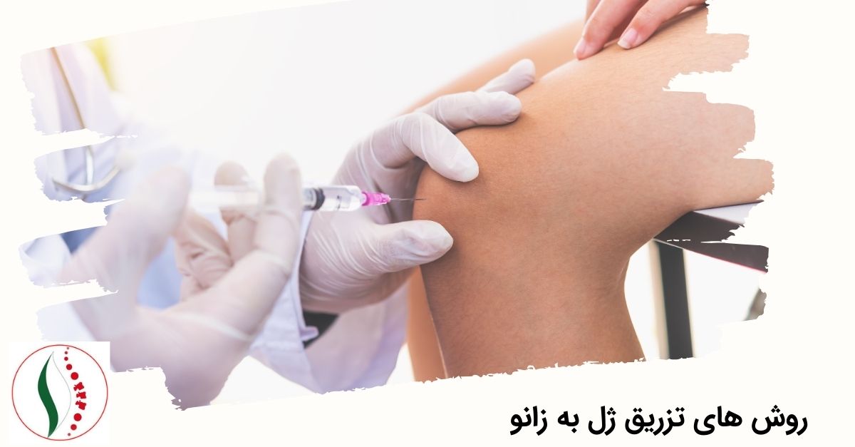 روش های تزریق ژل به زانو