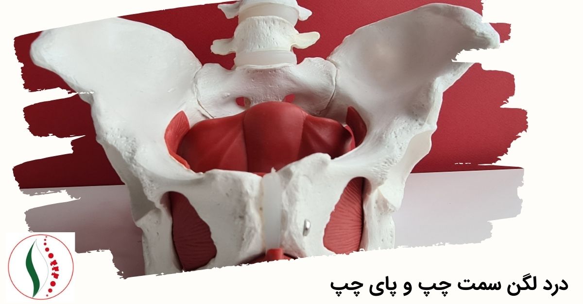 درد لگن سمت چپ و پای چپ چیست ؟