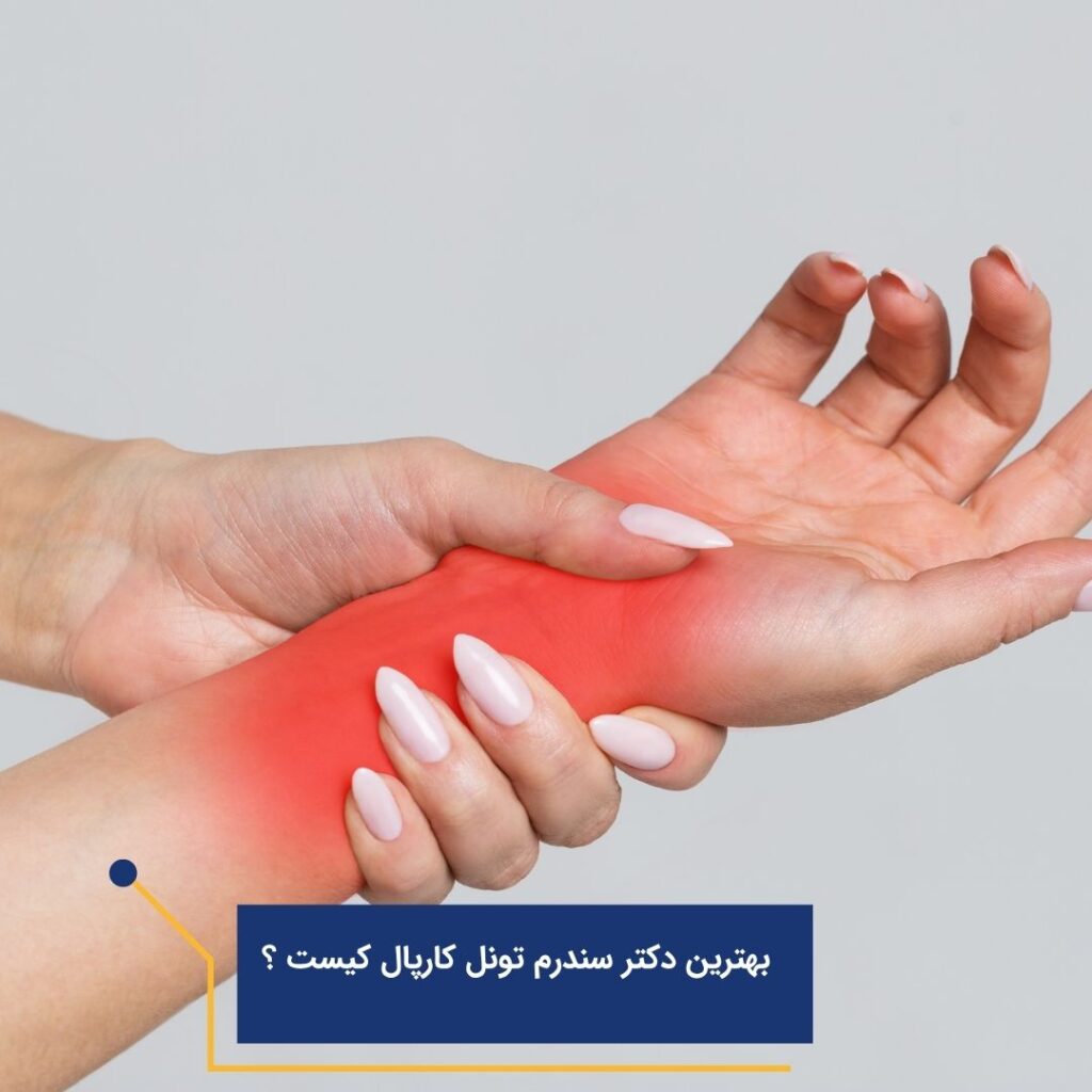 بهترین دکتر سندرم تونل کارپال