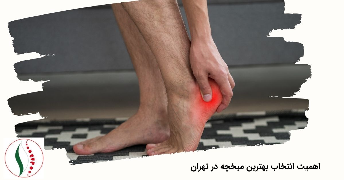 اهمیت انتخاب بهترین میخچه در تهران 