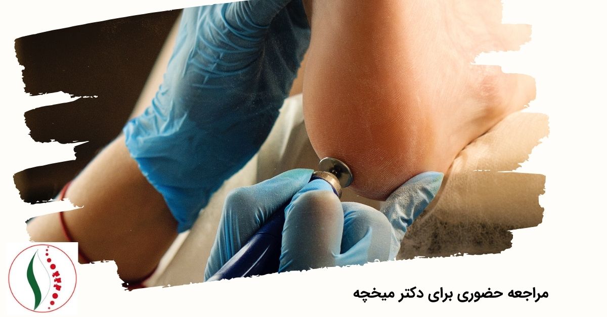 مراجعه حضوری برای انتخاب دکتر میخچه در تهران