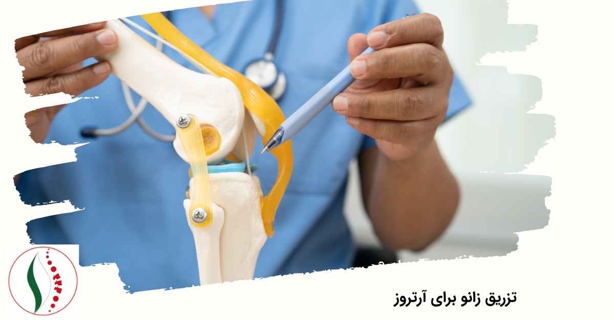 تزریق زانو برای آرتروز
