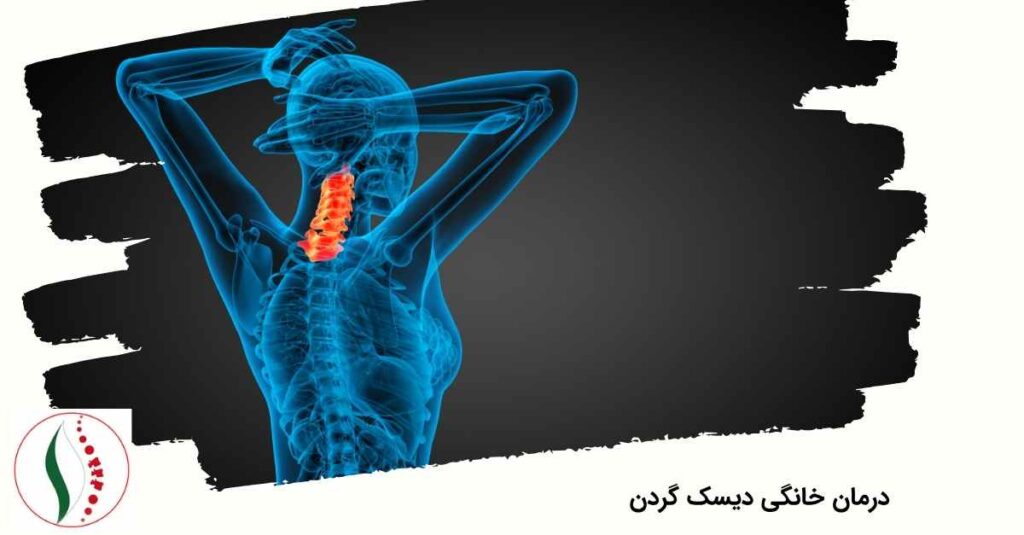 درمان خانگی دیسک گردن