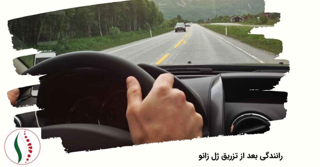رانندگی بعد از تزریق ژل زانو