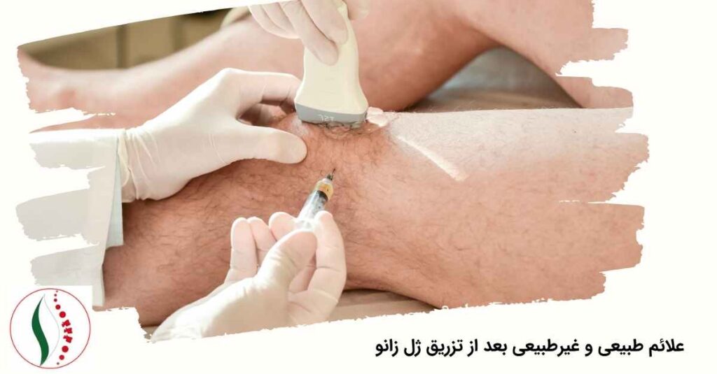 علائم طبیعی و غیرطبیعی بعد از تزریق ژل زانو