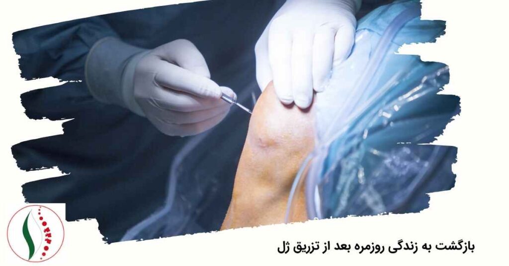 بازگشت به زندگی روزمره بعد از تزریق ژل