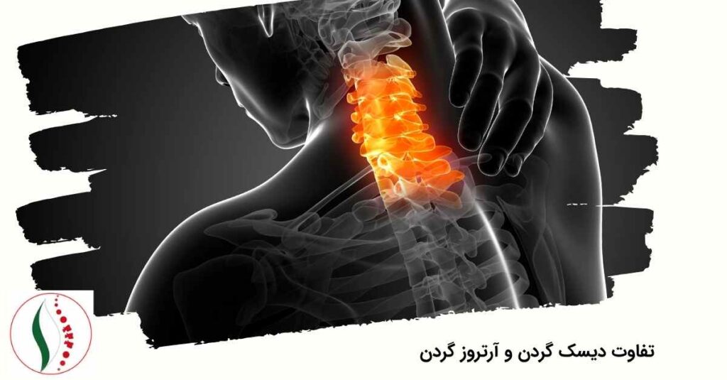 تفاوت دیسک گردن و آرتروز گردن