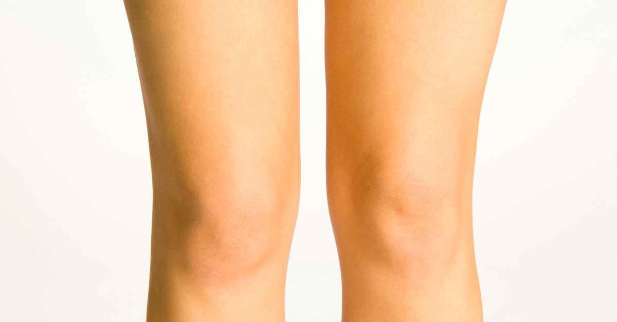تزریق ژل به زانو برای پارگی مینیسک