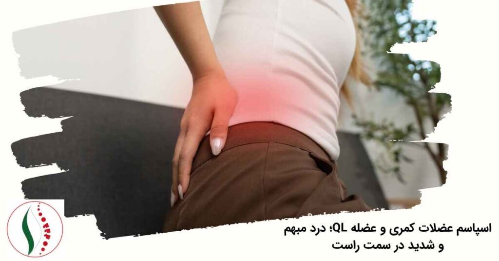 اسپاسم عضلات کمری