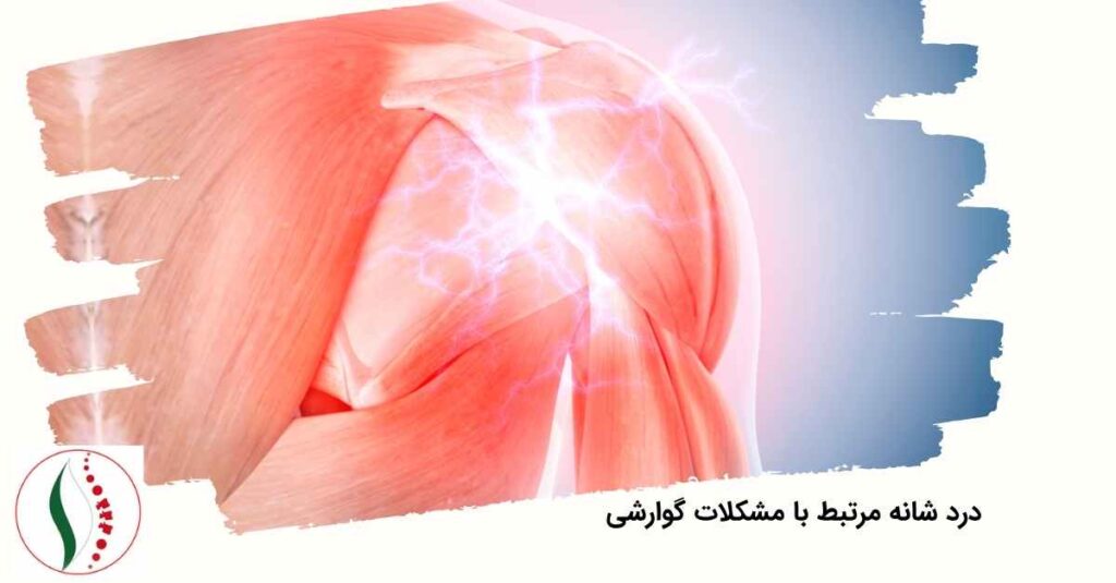  درد شانه مرتبط با مشکلات گوارشی