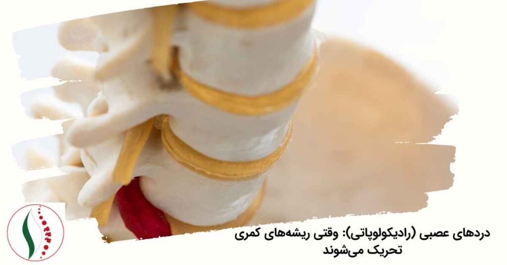 دردهای عصبی