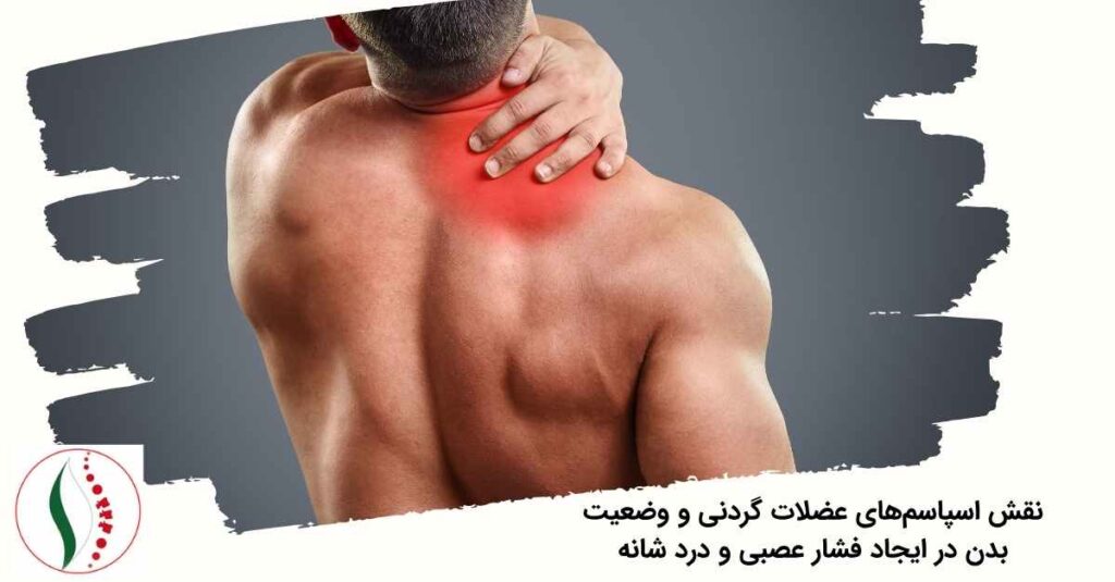 اسپاسم‌های عضلات گردنی