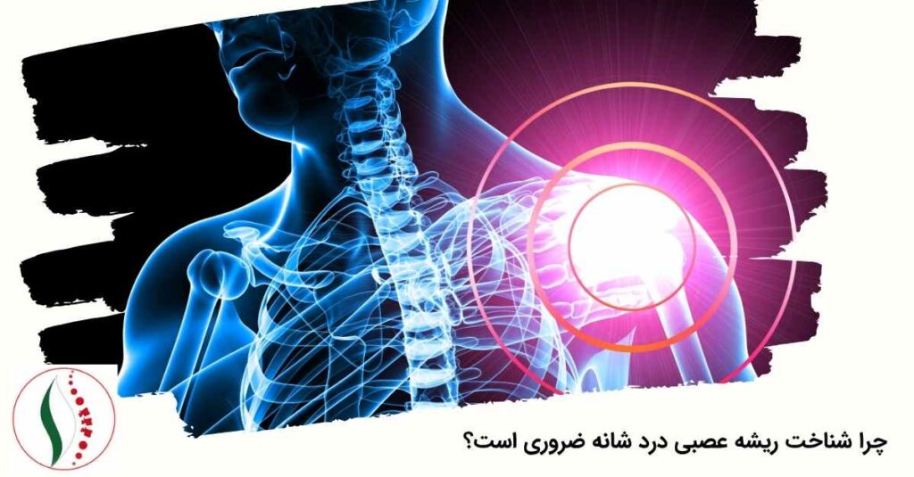 شناخت ریشه عصبی درد شانه