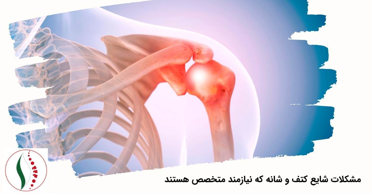 مشکلات شایع کتف و شانه که نیازمند متخصص هستند