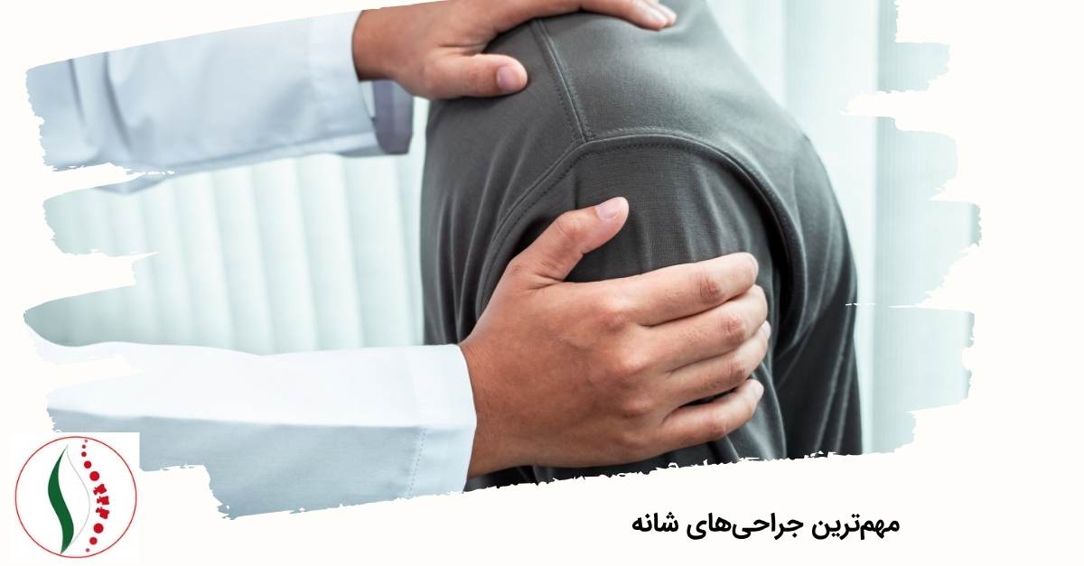 مهم‌ترین جراحی‌های شانه