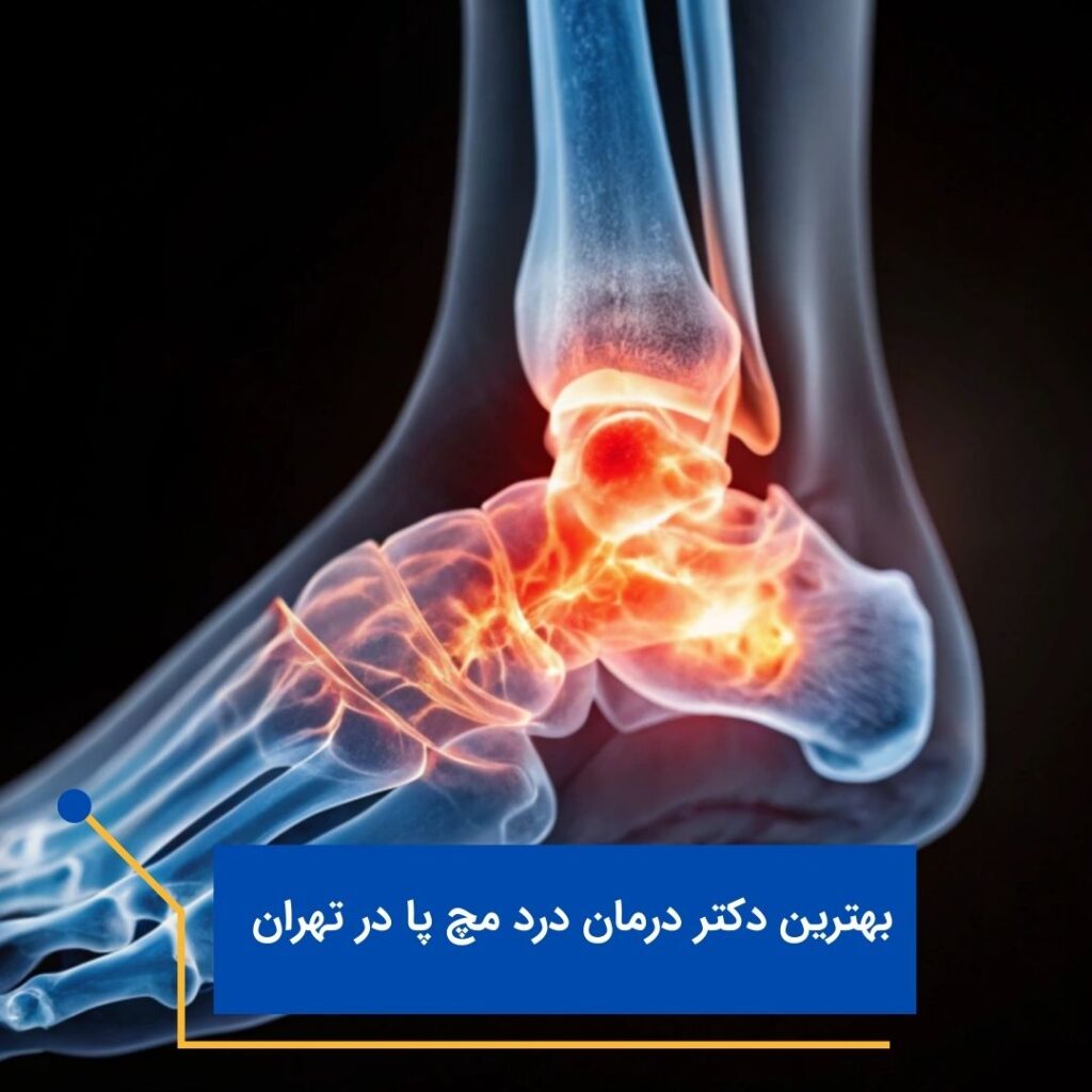 بهترین دکتر درد مچ پا در تهران