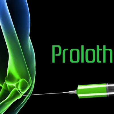 پرولوتراپی دکتر محمدرضا کاظمی