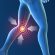 ما هو التهاب مفاصل الركبة وما هو العلاج