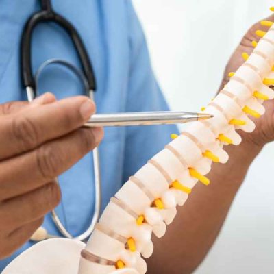 بهترین دارو برای تنگی کانال نخاعی