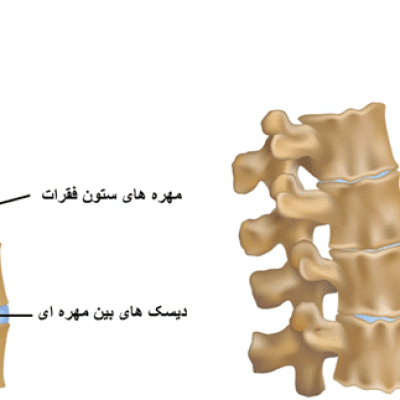 آرتروز گردن