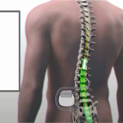 باطری های نخاعی