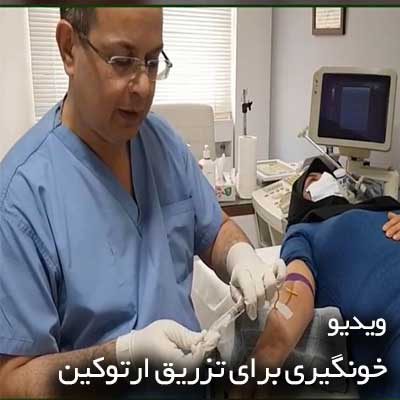 خونگیری برای تزریق ارتوکین