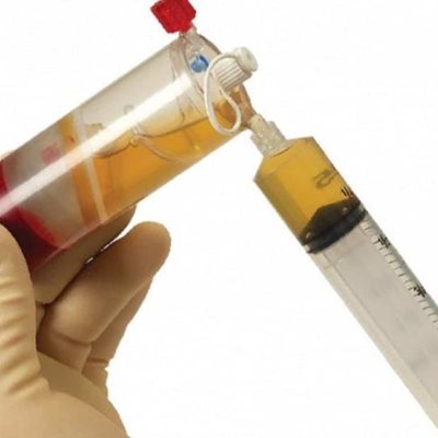 درمان با ارتوکین