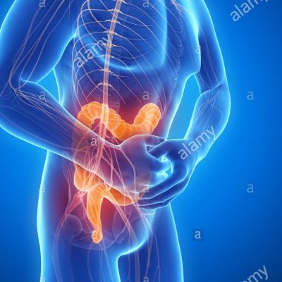 درمان دردهای شکم و لگن