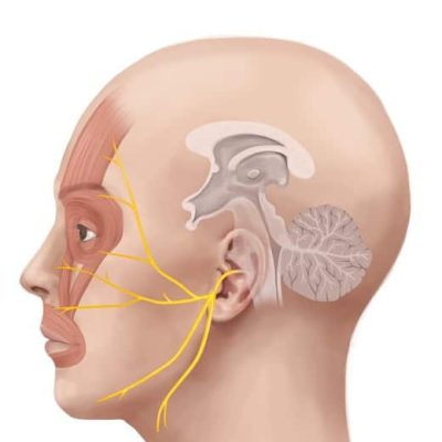 درمان دردهای صورت
