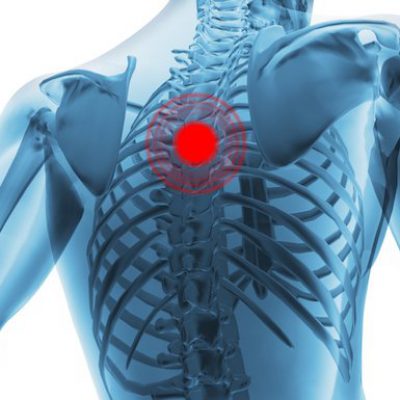 Thoracic pain tretment