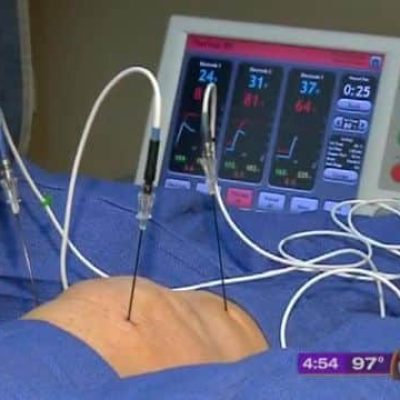 رادیوفرکوئنسی چیست